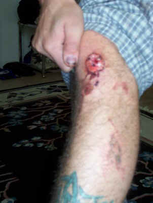 knee.jpg (35707 bytes)